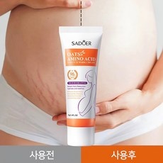 튼사렌살성크림