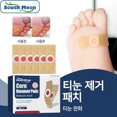 신신티눈밴드